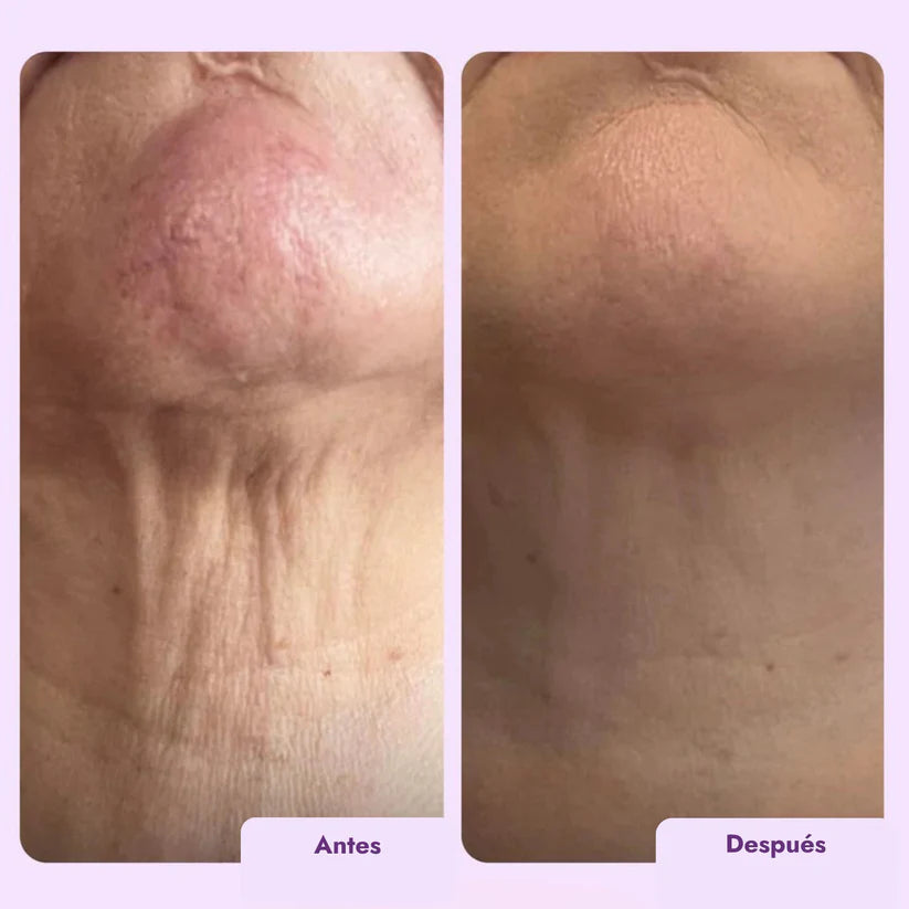 Reafirmante y tonificante para cuello y escote