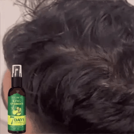 ¡Recupera tu cabello en solo 7 días! Crecimiento capilar efectivo y rápido