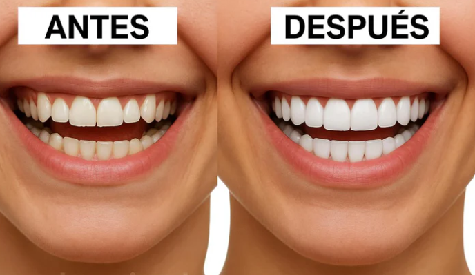 ¡Transforma tu sonrisa al instante con Sonrisa Instantánea!